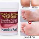 Miracle Herbal Feet Crack Cream