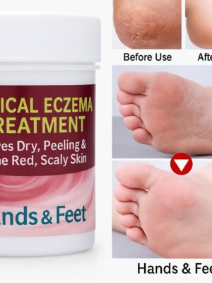 Miracle Herbal Feet Crack Cream