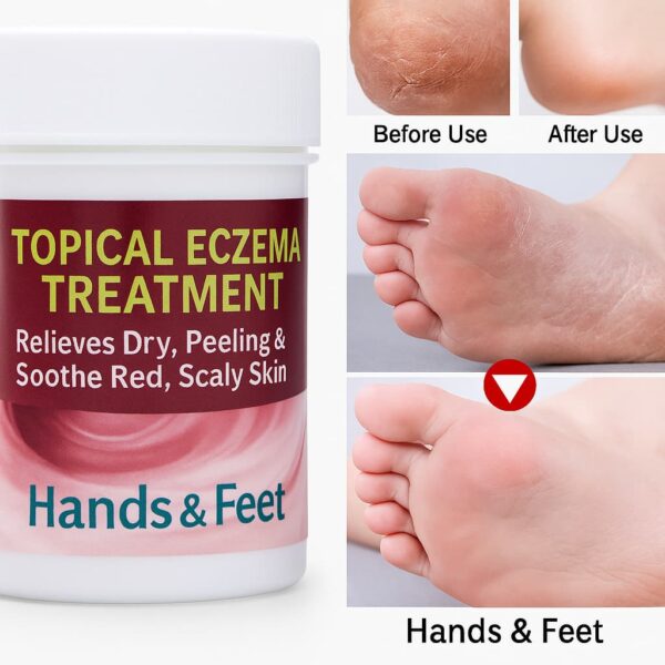 Miracle Herbal Feet Crack Cream